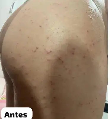 😍 Pele Lisa em Apenas 7 dias 😍 MILAGRE da Kojic🔥
