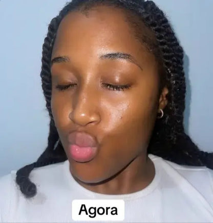 😍 Pele Lisa em Apenas 7 dias 😍 MILAGRE da Kojic🔥