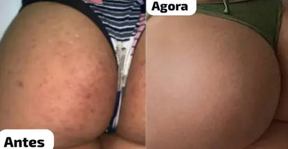 😍 Pele Lisa em Apenas 7 dias 😍 MILAGRE da Kojic🔥