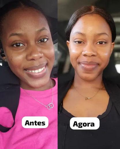 😍 Pele Lisa em Apenas 7 dias 😍 MILAGRE da Kojic🔥