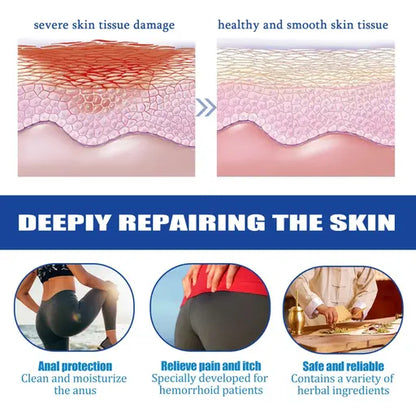 PRO CONFORT HEMORROIDAS™ - Alívio Rápido e Eficaz